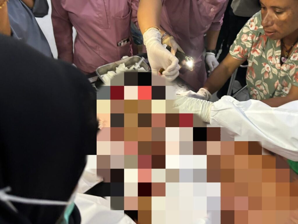 Lagi! Warga Sipil Jadi Korban penganiayaan dengan menggunakan senjata tajam di Yahukimo, Diduga Dilakukan KKB